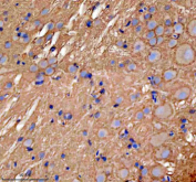 Zebrafish Gnao1a Antibody Brain Tissue IHC. Immunohistochemistry staining of FFPE zebrafish brain tissue with Zebrafish Gnao1a antibody, HRP secondary and DAB substrate. HIER: boil tissue sections in pH8 EDTA for 20 min and allow to cool before testing.