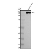 Zebrafish Aff4 Antibody Head Tissue WB. Western blot analysis of Aff4 protein using Zebrafish Aff4 antibody and zebrafish head tissue lysate. Predicted molecular weight ~118 kDa, commonly observed at 140-150 kDa. (human similarity)