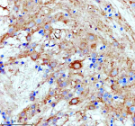 Zebrafish Luteinizing hormone beta / Lhb Antibody Hypothalamus IHC. Immunohistochemistry staining of zebrafish Luteinizing hormone beta protein using Zebrafish Luteinizing hormone beta antibody, HRP-labeled secondary and DAB substrate. Luteinizing hormone beta was detected in a paraffin-embedded section of zebrafish hypothalamus tissue. HIER: boil tissue sections in pH8 EDTA for 20 min and allow to cool before testing.