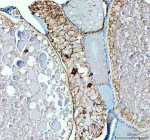 Zebrafish Luteinizing hormone beta / Lhb Antibody Ovary IHC. Immunohistochemistry staining of zebrafish Luteinizing hormone beta protein using Zebrafish Luteinizing hormone beta antibody, HRP-labeled secondary and DAB substrate. Luteinizing hormone beta was detected in a paraffin-embedded section of zebrafish ovary tissue. HIER: boil tissue sections in pH8 EDTA for 20 min and allow to cool before testing.