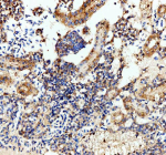 Zebrafish Luteinizing hormone beta / Lhb Antibody Kidney IHC. Immunohistochemistry staining of zebrafish Luteinizing hormone beta protein using Zebrafish Luteinizing hormone beta antibody, HRP-labeled secondary and DAB substrate. Luteinizing hormone beta was detected in a paraffin-embedded section of zebrafish kidney tissue. HIER: boil tissue sections in pH8 EDTA for 20 min and allow to cool before testing.