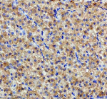 Zebrafish Hspa5 Antibody Liver Tissue IHC. Immunohistochemistry staining of FFPE zebrafish liver tissue with Hspa5 antibody, HRP-labeled secondary and DAB substrate. HIER: boil tissue sections in pH8 EDTA for 20 min and allow to cool before testing.