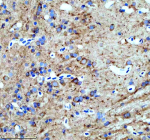 Zebrafish Hspa5 Antibody Brain Tissue IHC. Immunohistochemistry staining of FFPE zebrafish brain tissue with Hspa5 antibody, HRP-labeled secondary and DAB substrate. HIER: boil tissue sections in pH8 EDTA for 20 min and allow to cool before testing.