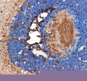 Zebrafish Fshb Antibody Eye Tissue IHC. Immunohistochemistry staining of FFPE zebrafish eye tissue with Zebrafish Fshb antibody, HRP-labeled secondary and DAB substrate. HIER: boil tissue sections in pH8 EDTA for 20 min and allow to cool before testing.