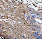 Zebrafish Flt1 / Vegfr1 Antibody Spinal Cord Tissue IHC. Immunohistochemistry staining of zebrafish Flt1 protein using Zebrafish Flt1 antibody, HRP-labeled secondary and DAB substrate. Flt1 was detected in a paraffin-embedded section of zebrafish spinal cord tissue. HIER: boil tissue sections in pH8 EDTA for 20 min and allow to cool before testing.
