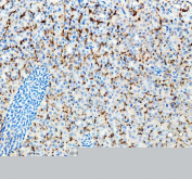 Zebrafish Lhcgr Antibody Kidney Tissue IHC. Immunohistochemistry staining of zebrafish Lhcgr protein using Zebrafish Lhcgr antibody, HRP-labeled secondary and DAB substrate. Lhcgr was detected in a paraffin-embedded section of zebrafish kidney tissue. HIER: boil tissue sections in pH8 EDTA for 20 min and allow to cool before testing.