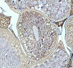 Zebrafish Lhcgr Antibody Ovary Tissue IHC. Immunohistochemistry staining of zebrafish Lhcgr protein using Zebrafish Lhcgr antibody, HRP-labeled secondary and DAB substrate. Lhcgr was detected in a paraffin-embedded section of zebrafish ovary tissue. HIER: boil tissue sections in pH8 EDTA for 20 min and allow to cool before testing.