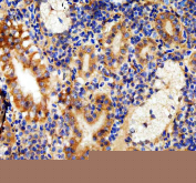 Zebrafish Lhcgr Antibody Liver Tissue IHC. Immunohistochemistry staining of zebrafish Lhcgr protein using Zebrafish Lhcgr antibody, HRP-labeled secondary and DAB substrate. Lhcgr was detected in a paraffin-embedded section of zebrafish liver tissue. HIER: boil tissue sections in pH8 EDTA for 20 min and allow to cool before testing.