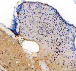 Zebrafish Her4 Antibody Brain Tissue IHC. Immunohistochemistry staining of zebrafish Her4 protein using Zebrafish Her4 antibody, HRP-labeled secondary and DAB substrate. Her4 was detected in a paraffin-embedded section of zebrafish brain tissue. HIER: boil tissue sections in pH8 EDTA for 20 min and allow to cool before testing.