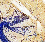 Zebrafish Her4 Antibody Brain Section IHC. Immunohistochemistry staining of zebrafish Her4 protein using Zebrafish Her4 antibody. Her4 was detected in a paraffin-embedded section of zebrafish brain tissue. HIER: boil tissue sections in pH8 EDTA for 20 min and allow to cool before testing.