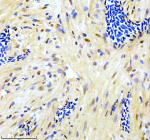 Zebrafish Gata6 Antibody Heart Tissue IHC. Immunohistochemistry staining of zebrafish Gata6 protein using Zebrafish Gata6 antibody, HRP-labeled secondary and DAB substrate. Gata6 was detected in a paraffin-embedded section of zebrafish heart tissue. HIER: boil tissue sections in pH8 EDTA for 20 min and allow to cool before testing.