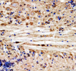 Zebrafish Hsd3b1 Antibody Brain Tissue IHC. Immunohistochemistry staining of FFPE zebrafish brain tissue with Zebrafish Hsd3b1 antibody, HRP-labeled secondary and DAB substrate. HIER: boil tissue sections in pH8 EDTA for 20 min and allow to cool before testing.