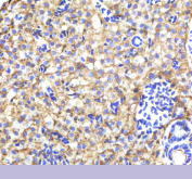 Zebrafish Alcama Antibody Liver Tissue IHC. Immunohistochemistry staining of FFPE zebrafish liver tissue with Zebrafish Alcama antibody, HRP-labeled secondary and DAB substrate. HIER: boil tissue sections in pH8 EDTA for 20 min and allow to cool before testing.