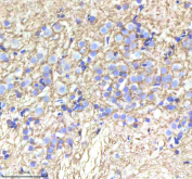 Zebrafish Alcama Antibody Brain Tissue IHC. Immunohistochemistry staining of FFPE zebrafish brain tissue with Zebrafish Alcama antibody, HRP-labeled secondary and DAB substrate. HIER: boil tissue sections in pH8 EDTA for 20 min and allow to cool before testing.