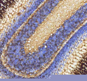 Zebrafish Caspase 9 Antibody Eye Tissue IHC. Immunohistochemistry staining of FFPE zebrafish eye tissue with Zebrafish Caspase 9 antibody, HRP-labeled secondary and DAB substrate. HIER: boil tissue sections in pH8 EDTA for 20 min and allow to cool before testing.