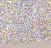 Zebrafish Caspase 9 Antibody Liver Tissue IHC. Immunohistochemistry staining of FFPE zebrafish liver tissue with Zebrafish Caspase 9 antibody, HRP-labeled secondary and DAB substrate. HIER: boil tissue sections in pH8 EDTA for 20 min and allow to cool before testing.
