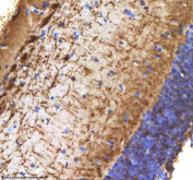 Zebrafish Cxcl12 Antibody Brain Tissue IHC. Immunohistochemistry staining of zebrafish Cxcl12 protein using Zebrafish Cxcl12 antibody, HRP-labeled secondary and DAB substrate. Cxcl12 was detected in a paraffin-embedded section of zebrafish brain tissue. HIER: boil tissue sections in pH8 EDTA for 20 min and allow to cool before testing.
