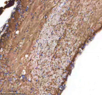 Zebrafish Cxcl12 Antibody Spinal Cord Tissue IHC. Immunohistochemistry staining of zebrafish Cxcl12 protein using Zebrafish Cxcl12 antibody, HRP-labeled secondary and DAB substrate. Cxcl12 was detected in a paraffin-embedded section of zebrafish spinal cord tissue. HIER: boil tissue sections in pH8 EDTA for 20 min and allow to cool before testing.
