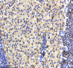 Zebrafish Cyp19a1b / Aromatase Antibody Liver Tissue IHC. Immunohistochemistry staining of FFPE zebrafish liver tissue with Cyp19a1b antibody, HRP-labeled secondary and DAB substrate. HIER: boil tissue sections in pH8 EDTA for 20 min and allow to cool before testing.