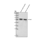 Zebrafish Cyp26a1 / Cytochrome P450 26A1 Antibody Tissue WB. Western blot analysis of Cyp26a1 protein using Zebrafish Cyp26a1 antibody and 1) whole female zebrafish tissue lysates and 2) whole male zebrafish tissue lysates. Predicted molecular weight ~56 kDa.