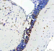 Zebrafish Dgcr8 Antibody Brain Tissue IHC. Immunohistochemistry staining of FFPE zebrafish brain tissue with Dgcr8 antibody, HRP-labeled secondary and DAB substrate. HIER: boil tissue sections in pH8 EDTA for 20 min and allow to cool before testing.