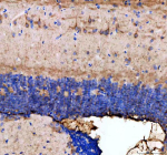 Zebrafish Dnm1 Antibody Brain Tissue IHC. Immunohistochemistry staining of FFPE zebrafish brain tissue with Zebrafish Dnm1 / Dynamin antibody, HRP-labeled secondary and DAB substrate. HIER: boil tissue sections in pH8 EDTA for 20 min and allow to cool before testing.
