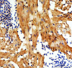 Zebrafish E-cadherin Antibody heart tissue IHC. Immunohistochemistry staining of FFPE zebrafish heart tissue with Zebrafish E-cadherin antibody, HRP-labeled secondary and DAB substrate. HIER: boil tissue sections in pH8 EDTA for 20 min and allow to cool before testing.