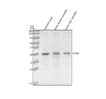 Zebrafish Etv2 Antibody Tissue WB. Western blot analysis of Etv2 protein using Zebrafish Etv2 antibody and 1) zebrafish head, 2) whole female zebrafish and 3) whole male zebrafish tissue lysate. Predicted molecular weight ~40 kDa.
