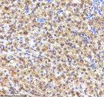 Zebrafish Fasn Antibody Liver Tissue IHC. Immunohistochemistry staining of FFPE zebrafish liver tissue with Fasn antibody, HRP-labeled secondary and DAB substrate. HIER: boil tissue sections in pH8 EDTA for 20 min and allow to cool before testing.