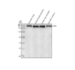 Zebrafish Fasn Antibody Tissue WB. Western blot analysis of Fasn protein using Zebrafish Fasn antibody and 1) zebrafish head, 2) whole female zebrafish, 3) whole male zebrafish and 4) zebrafish embryo tissue lysate. Predicted molecular weight ~274 kDa.