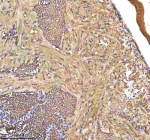 Zebrafish Hbae1.1 Antibody Heart Tissue IHC. Immunohistochemistry staining of FFPE zebrafish heart tissue with Hbae1.1 antibody, HRP-labeled secondary and DAB substrate. HIER: boil tissue sections in pH8 EDTA for 20 min and allow to cool before testing.