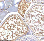 Zebrafish Igf1 Antibody Ovary Tissue IHC. Immunohistochemistry staining of zebrafish Insulin like growth factor 1 protein using Zebrafish Insulin like growth factor 1 antibody, HRP-labeled secondary and DAB substrate. Igf1 was detected in a paraffin-embedded section of zebrafish ovary tissue. HIER: boil tissue sections in pH8 EDTA for 20 min and allow to cool before testing.