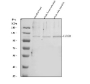 Zebrafish Leo1 Antibody Tissue WB. Western blot analysis of Leo1 protein using Zebrafish Leo1 antibody and 1) zebrafish head, 2) whole female zebrafish and 3) whole male zebrafish tissue lysate. Predicted molecular weight ~76 kDa but can be observed at ~105 kDa (human similarity).