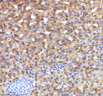 Zebrafish Lysozyme Antibody Liver Tissue IHC. Immunohistochemistry staining of FFPE zebrafish liver tissue with Zebrafish Lysozyme antibody, HRP-labeled secondary and DAB substrate. HIER: boil tissue sections in pH8 EDTA for 20 min and allow to cool before testing.