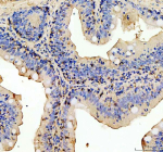 Zebrafish Myd88 Antibody Colon Tissue IHC. Immunohistochemistry staining of FFPE zebrafish colon tissue with Myd88 antibody, HRP-labeled secondary and DAB substrate. HIER: boil tissue sections in pH8 EDTA for 20 min and allow to cool before testing.
