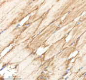 Zebrafish Ppp1r12a Antibody Muscle Tissue IHC. Immunohistochemistry staining of FFPE zebrafish muscle tissue with Ppp1r12a antibody, HRP-labeled secondary and DAB substrate. HIER: boil tissue sections in pH8 EDTA for 20 min and allow to cool before testing.