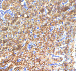 Zebrafish Nanos3 Antibody Pancreas Tissue IHC. Immunohistochemistry staining of zebrafish Nanos3 protein using Zebrafish Nanos3 antibody, HRP-labeled secondary and DAB substrate. Nanos3 was detected in a paraffin-embedded section of zebrafish pancreas tissue. HIER: boil tissue sections in pH8 EDTA for 20 min and allow to cool before testing.