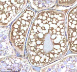 Zebrafish Nanos3 Antibody Ovary Tissue IHC. Immunohistochemistry staining of zebrafish Nanos3 protein using Zebrafish Nanos3 antibody, HRP-labeled secondary and DAB substrate. Nanos3 was detected in a paraffin-embedded section of zebrafish ovary tissue. HIER: boil tissue sections in pH8 EDTA for 20 min and allow to cool before testing.