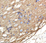 Zebrafish Ndr1 Antibody Spinal Cord Tissue IHC. Immunohistochemistry staining of zebrafish Ndr1 protein using Zebrafish Ndr1 antibody, HRP-labeled secondary and DAB substrate. Ndr1 was detected in a paraffin-embedded section of zebrafish spinal cord tissue. HIER: boil tissue sections in pH8 EDTA for 20 min and allow to cool before testing.