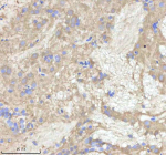 Zebrafish Npepps Antibody Brain Tissue IHC. Immunohistochemistry staining of zebrafish Npepps protein using Zebrafish Npepps antibody, HRP-labeled secondary and DAB substrate. Npepps was detected in a paraffin-embedded section of zebrafish brain tissue. HIER: boil tissue sections in pH8 EDTA for 20 min and allow to cool before testing.