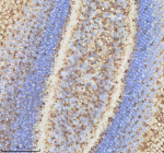Zebrafish Npepps Antibody Eye Tissue IHC. Immunohistochemistry staining of zebrafish Npepps protein using Zebrafish Npepps antibody, HRP-labeled secondary and DAB substrate. Npepps was detected in a paraffin-embedded section of zebrafish eye tissue. HIER: boil tissue sections in pH8 EDTA for 20 min and allow to cool before testing.