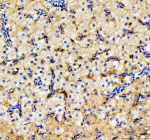 Zebrafish Ostf1 Antibody Liver Tissue IHC. Immunohistochemistry staining of FFPE zebrafish liver tissue with Ostf1 antibody, HRP-labeled secondary and DAB substrate. HIER: boil tissue sections in pH8 EDTA for 20 min and allow to cool before testing.