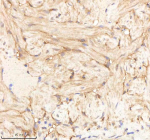 Zebrafish Pa2g4 Antibody Heart Tissue IHC. Immunohistochemistry staining of zebrafish Pa2g4 protein using Zebrafish Pa2g4 antibody, HRP-labeled secondary and DAB substrate. Pa2g4 was detected in a paraffin-embedded section of zebrafish heart tissue. HIER: boil tissue sections in pH8 EDTA for 20 min and allow to cool before testing.