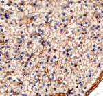 Zebrafish Pa2g4 Antibody Liver Tissue IHC. Immunohistochemistry staining of zebrafish Pa2g4 protein using Zebrafish Pa2g4 antibody, HRP-labeled secondary and DAB substrate. Pa2g4 was detected in a paraffin-embedded section of zebrafish liver tissue. HIER: boil tissue sections in pH8 EDTA for 20 min and allow to cool before testing.