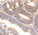 Zebrafish Pard3aa Antibody Colon Tissue IHC. Immunohistochemistry staining of zebrafish Pard3aa protein using Zebrafish Pard3aa antibody, HRP-labeled secondary and DAB substrate. Pard3aa was detected in a paraffin-embedded section of zebrafish colon tissue. HIER: boil tissue sections in pH8 EDTA for 20 min and allow to cool before testing.