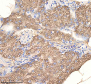 Zebrafish Pdcd10 Antibody Pancreas Tissue IHC. Immunohistochemistry staining of zebrafish Pdcd10a/b protein using Zebrafish Pdcd10 antibody, HRP-labeled secondary and DAB substrate. Pdcd10 was detected in a paraffin-embedded section of zebrafish pancreas tissue. HIER: boil tissue sections in pH8 EDTA for 20 min and allow to cool before testing.