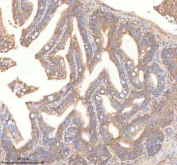 Zebrafish Pdcd10 Antibody Colon Tissue IHC. Immunohistochemistry staining of zebrafish Pdcd10 protein using Zebrafish Pdcd10 antibody, HRP-labeled secondary and DAB substrate. Pdcd10a/b was detected in a paraffin-embedded section of zebrafish colon tissue. HIER: boil tissue sections in pH8 EDTA for 20 min and allow to cool before testing.