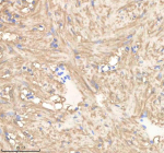Zebrafish Pgam1 Antibody Heart Tissue IHC. Immunohistochemistry staining of zebrafish Pgam1a/b protein using Zebrafish Pgam1 antibody, HRP-labeled secondary and DAB substrate. Pgam1 was detected in a paraffin-embedded section of zebrafish heart tissue. HIER: boil tissue sections in pH8 EDTA for 20 min and allow to cool before testing.