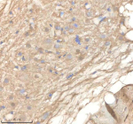 Zebrafish Ppm1g Antibody Brain Tissue IHC. Immunohistochemistry staining of zebrafish Ppm1g protein using Zebrafish Ppm1g antibody, HRP-labeled secondary and DAB substrate. Ppm1g was detected in a paraffin-embedded section of zebrafish brain tissue. HIER: boil tissue sections in pH8 EDTA for 20 min and allow to cool before testing.