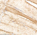 Zebrafish Psmb1 Antibody Muscle Tissue IHC. Immunohistochemistry staining of FFPE zebrafish muscle tissue with Psmb1 antibody, HRP-labeled secondary and DAB substrate. HIER: boil tissue sections in pH8 EDTA for 20 min and allow to cool before testing.
